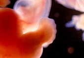 Human embryo after 6-7 weeks