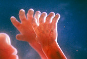 Foetus hands at 22 weeks old