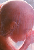 Head of a human foetus at five months