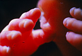 Hands & mouth of 22 week old foetus