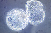 LM of hatching blastocyst in IVF