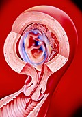 Illustration of threatened abortion of a foetus