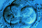 LM of human embryo at four-cell stage,after IVF