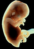 Side view of an eleven week old human foetus
