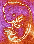 Artwork of a seven week-old embryo