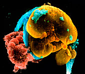 Coloured SEM of a 6-8 cell segmenting human embryo