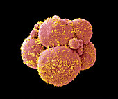 Human embryo at 8 cell stage