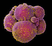 Coloured SEM of human embryo at 8-cell stage