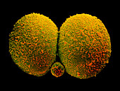 Coloured SEM of human embryo at the 2-cell stage