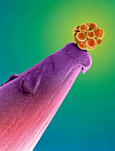 16-cell human embryo on a pin,SEM