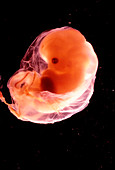 View of a human foetus,8 weeks old