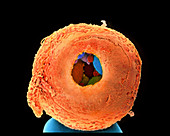 Coloured SEM of 8-cell human embryo drilled open