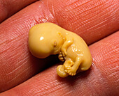 Hand holds an aborted human foetus aged 8 weeks