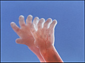 Human foetus of 5 months showing hands