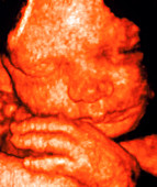 Ultrasound of foetus' face