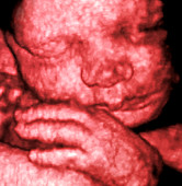 Coloured 3-D ultrasound scan of a foetus
