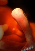 Legs and genitalia of a 22 week old male foetus