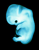 Coloured side view of a 44 day old human embryo