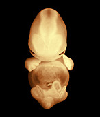 Frontal view of a 6 week old embryo