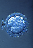 LM of a four-cell embryo showing its blastomeres