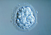 Aborting embryo