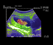 9 week foetus ultrasound