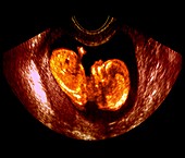 37 week foetus,ultrasound scan