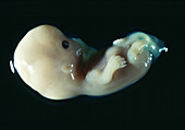 Five-week-old embryo