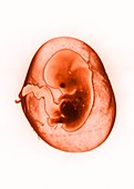 Eight-week-old foetus