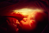 20 week old foetus