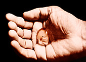 Hand holding foetus