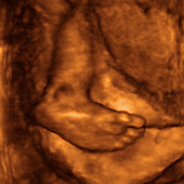 Foetus' foot,ultrasound scan