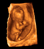 Foetus at 14 weeks,3-D ultrasound scan