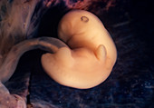 Embryo at six weeks