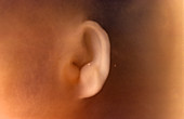 Foetal ear at 12 weeks