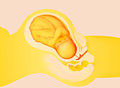 Full-term foetus