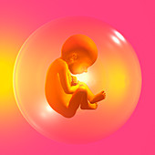 Foetus in bubble
