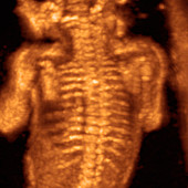 Foetus skeleton,3-D ultrasound scan