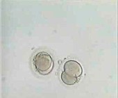 2-cell embryos,light micrograph