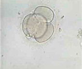 4-cell embryo,light micrograph