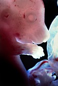 Close-up of a rat embryo at 17.5 days gestation