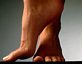 Healthy feet of a woman,raised onto their toes