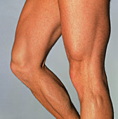 Muscular legs of athletic young man