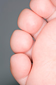 Child's toes