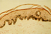 Light micrograph of skin stained to show melanin
