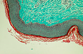 LM of human skin showing the dermis