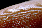 Fingerprint skin ridges