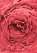 SEM of sweat pore on surface of skin