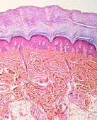 LM of section of skin from human finger