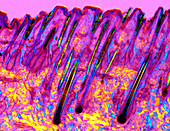 Human skin,polarised light micrograph